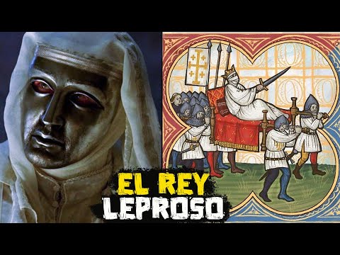 El Rey Leproso de Jerusalén: Un intrigante relato histórico